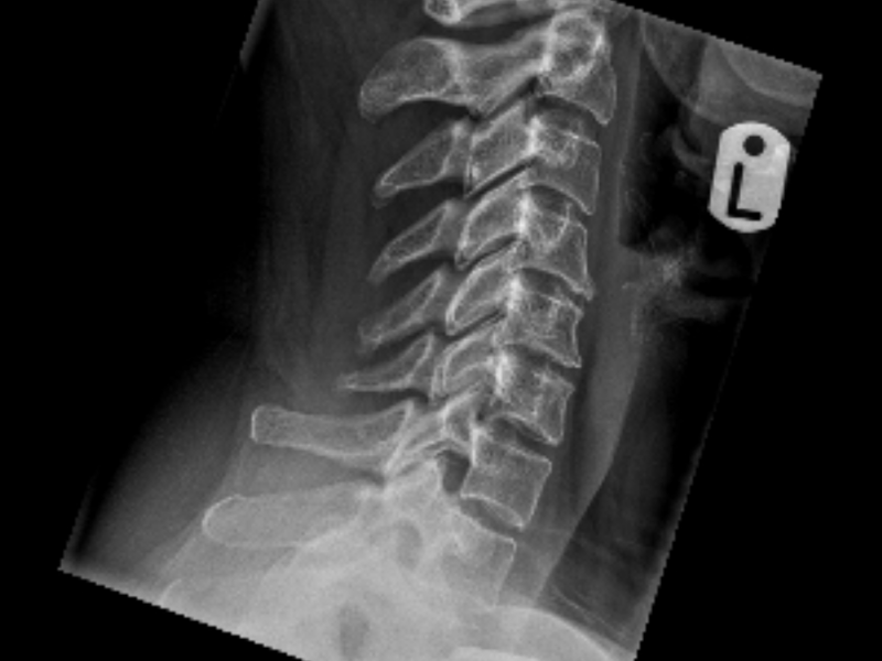 neck x-ray