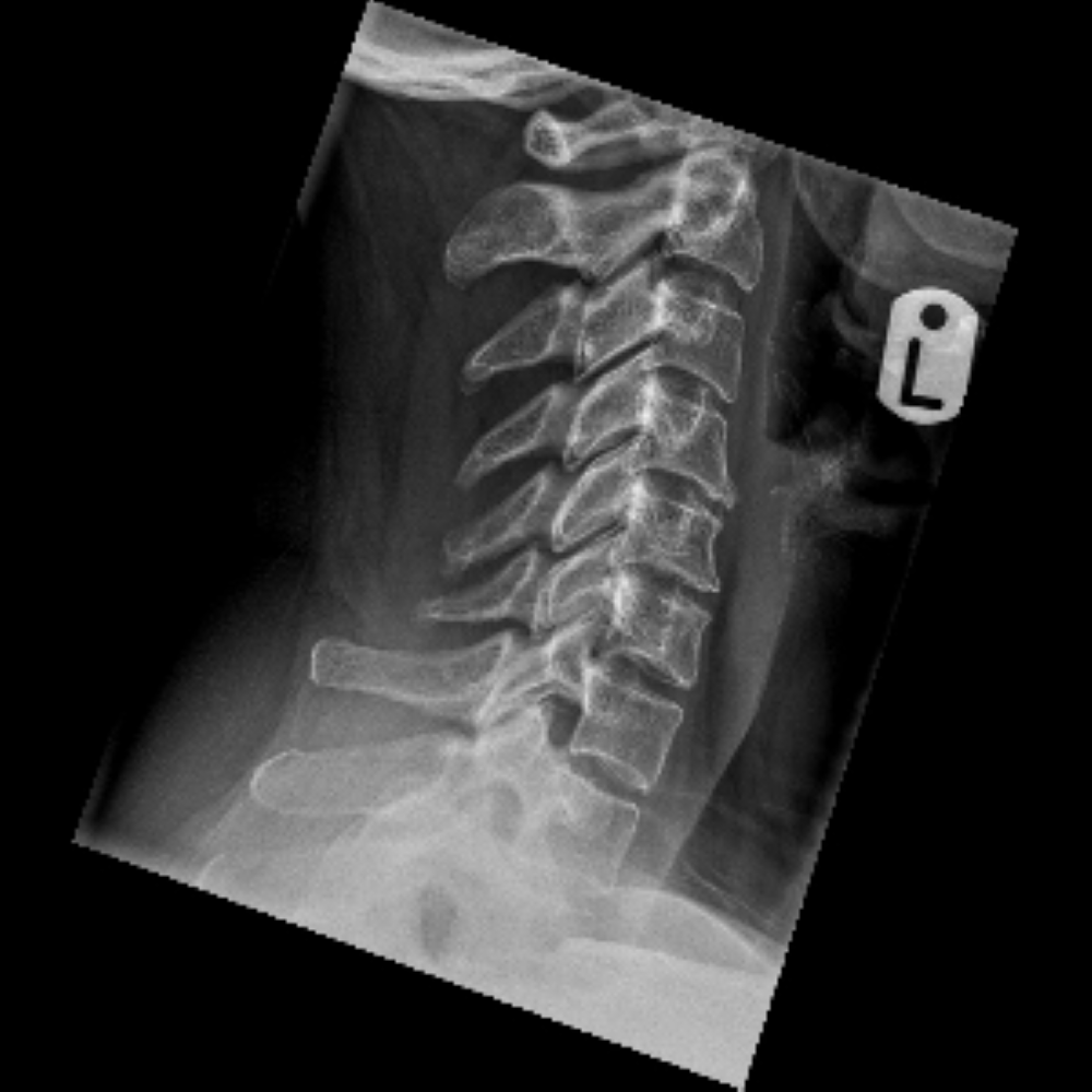 neck x-ray